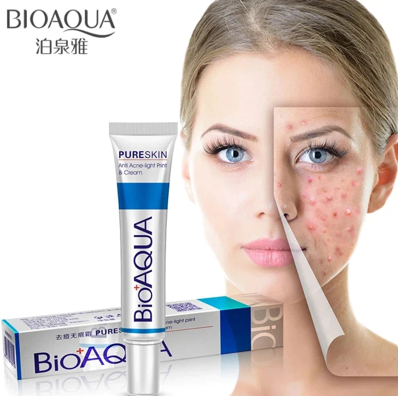 Original Bio-aqua Acne Cream For All Skin