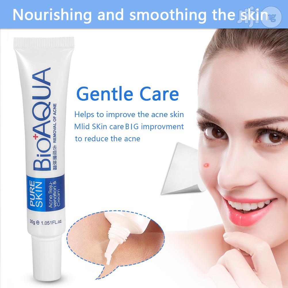 Original Bio-aqua Acne Cream For All Skin