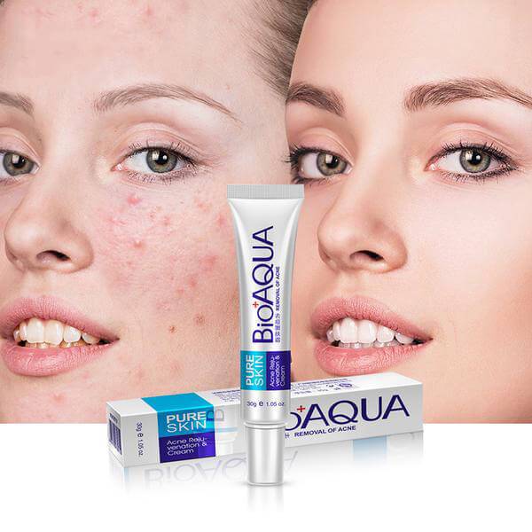 Original Bio-aqua Acne Cream For All Skin