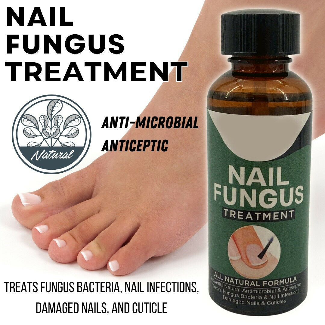 Nail Fungus Treatment Stop Fungal Growth Effective Fingernail 10ml